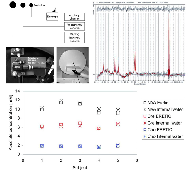 Enlarged view: ERETIC: setup, appearance in the spectrum and cross validation with internal water reference in 5 healthy subjects